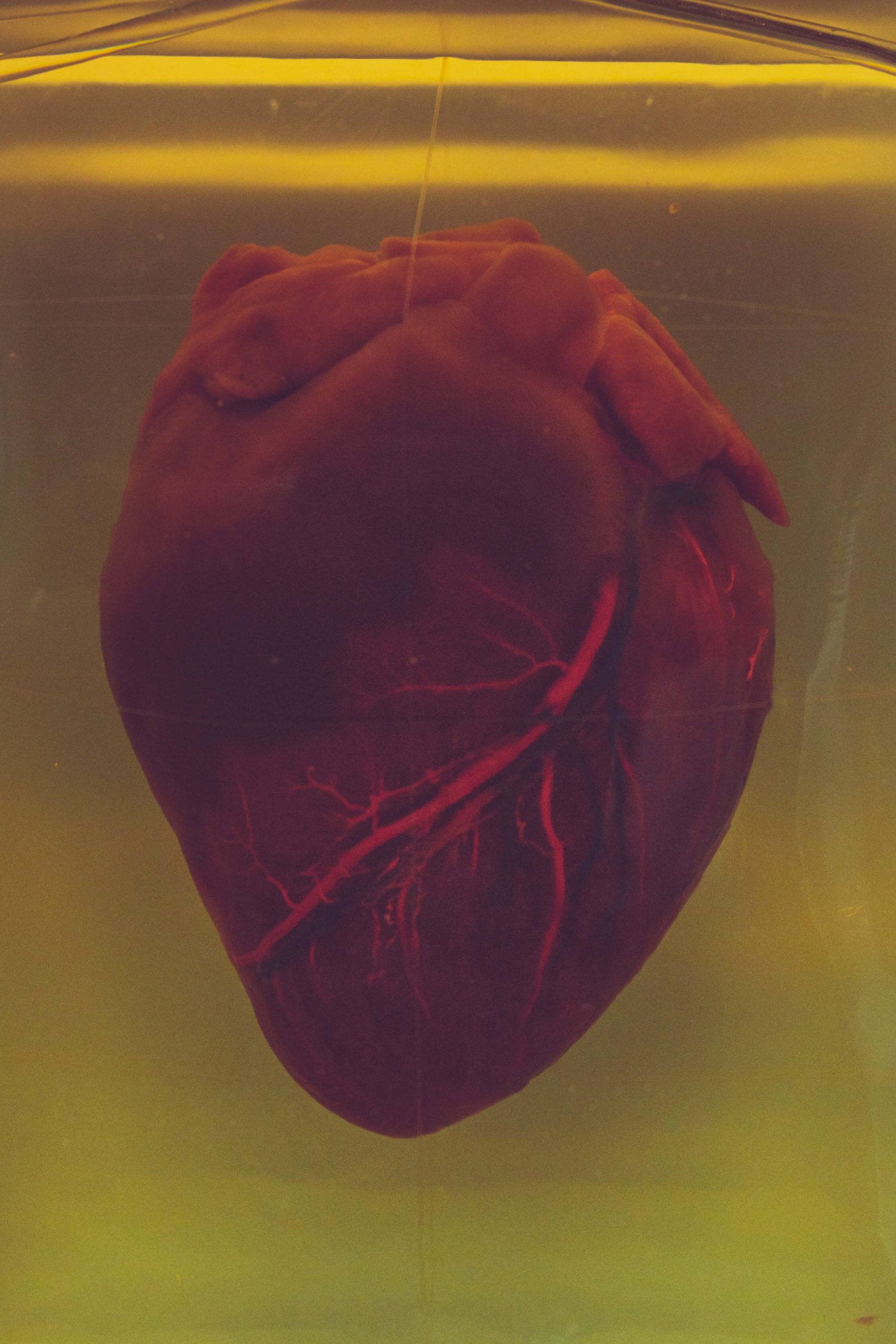 Illustration de l’article « Combien de temps dure une thrombose ? »